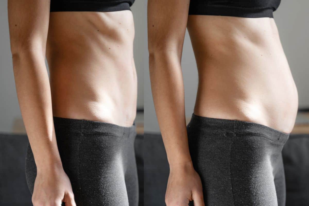 How long does diastasis recti take to improve Ruislip Common?