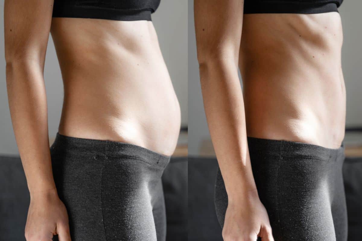Post-Pregnancy: What Happens to Your Abdominal Muscles After Birth Ruislip Common