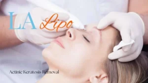 Woman receiving Actinic Keratosis Removal Treatment Ruislip Common