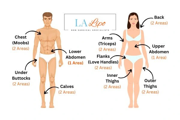LA LIPO Cryolipolysis Areas Ruislip Common