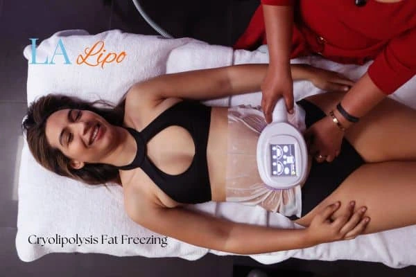 woman getting cryolipolysis Ruislip Common