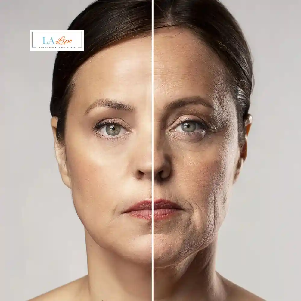 How Can You Tell If Non-Surgical Skin Tightening Is Right for You Ruislip Common?