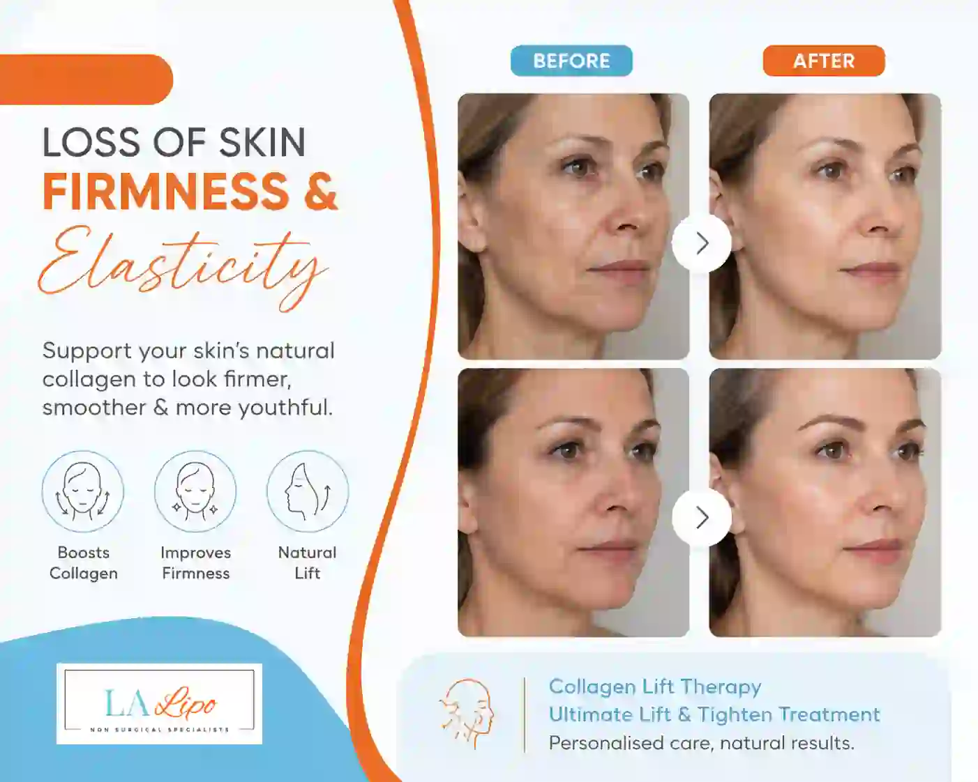 Sign #7: Loss of Skin Firmness and Elasticity Ruislip Common