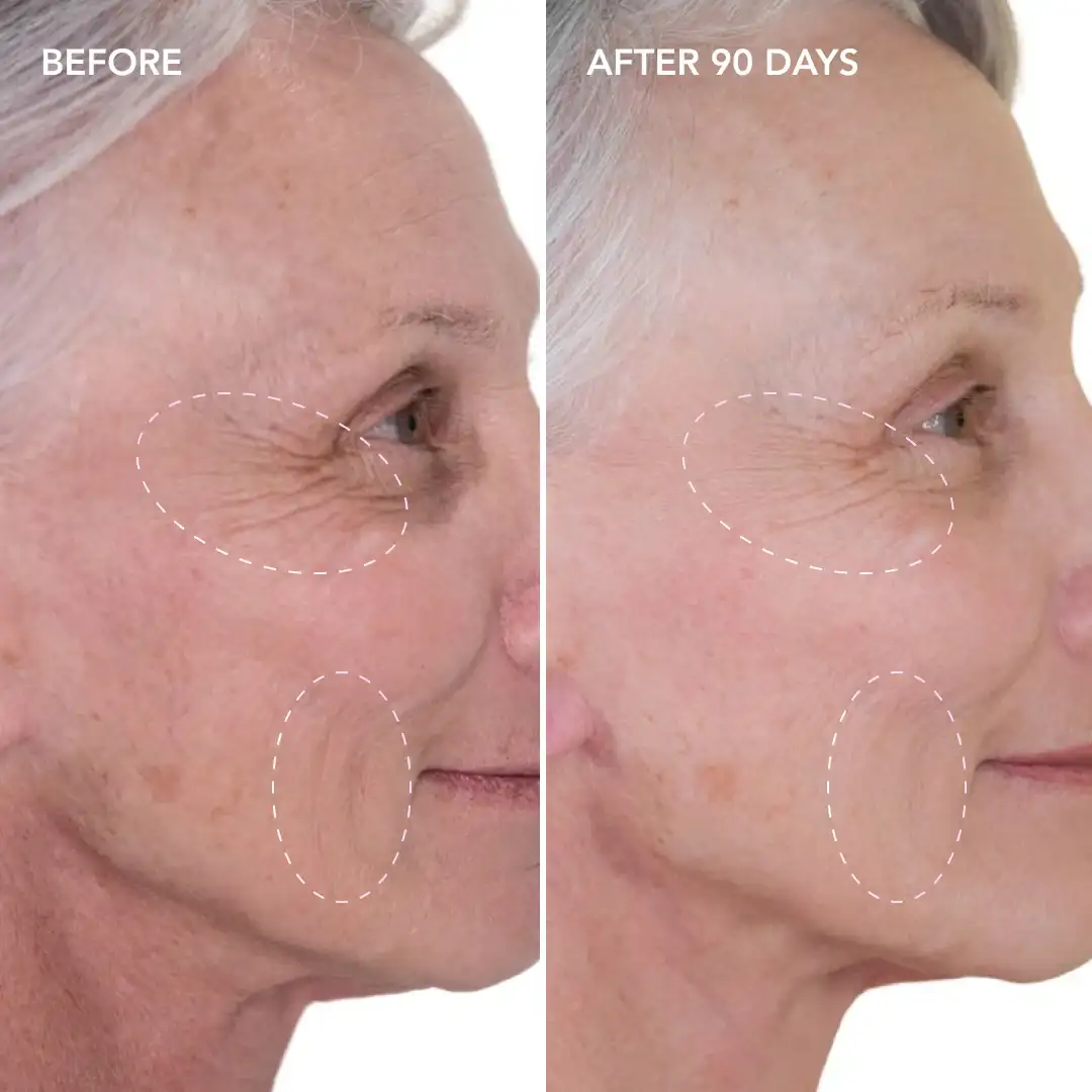 When will you see results Ruislip Common